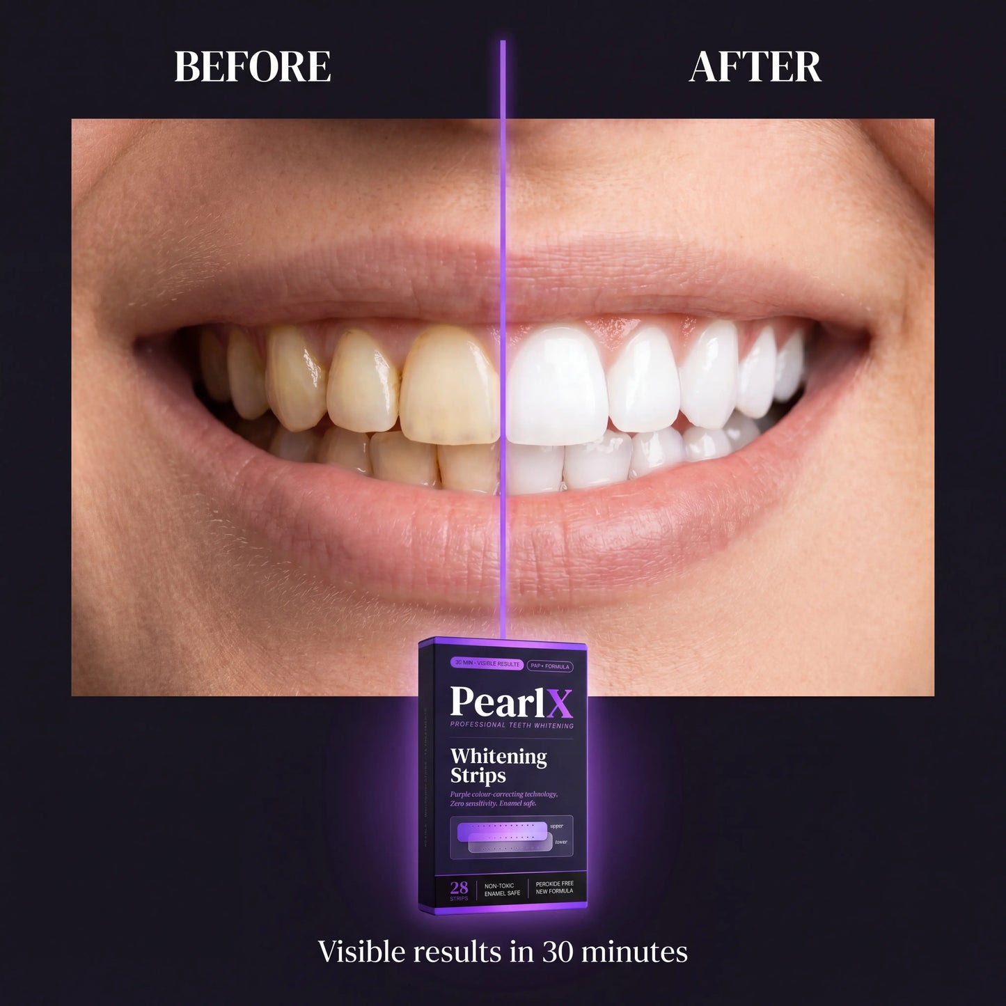 PearlX™ Whitening Strips